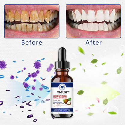 Negusy™ Coconut Fresh Oil-Pulling Mouthwash