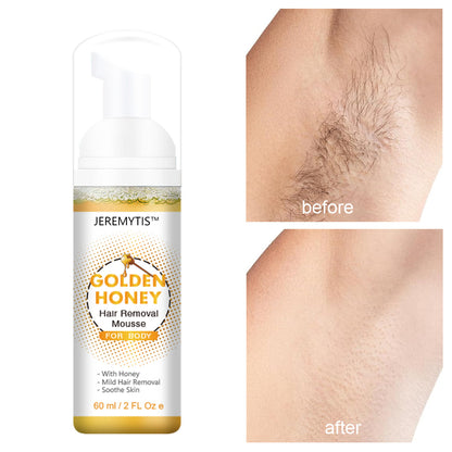 ✨JEREMYTIS™ Say Goodbye to Body Hair